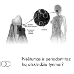 nėštumas ir periodontitas
