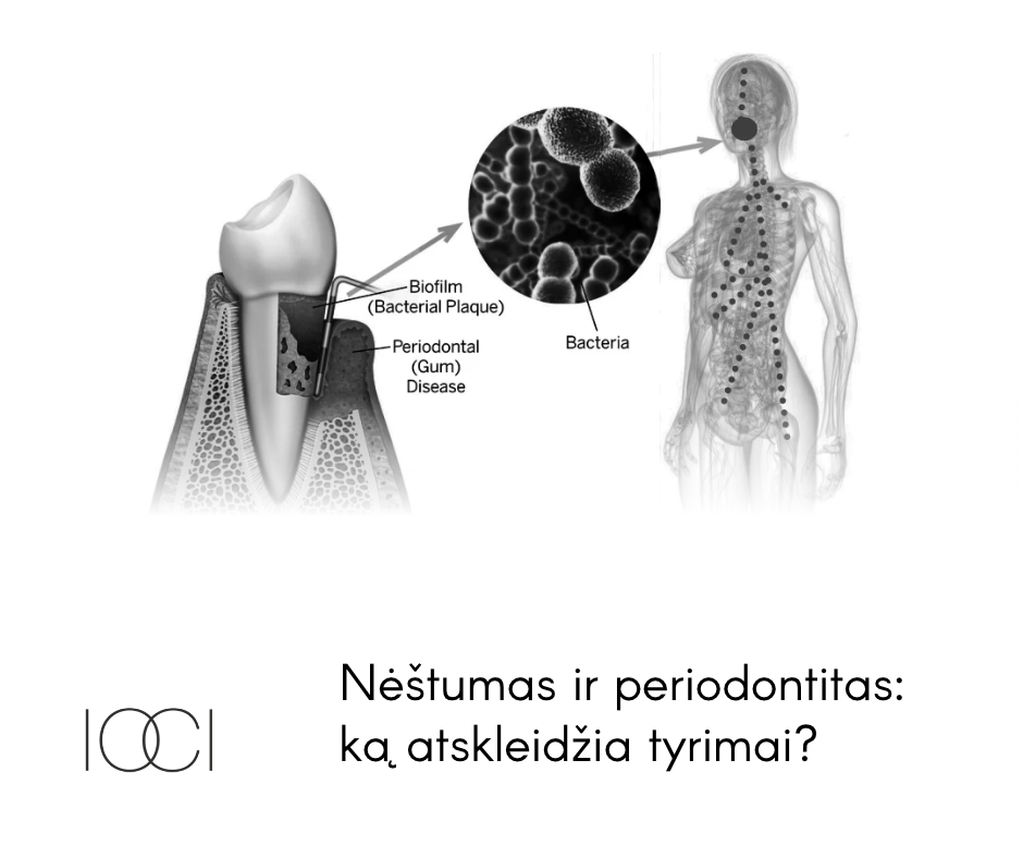 nėštumas ir periodontitas